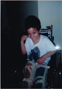 "5-year-old Angel in a wheelchair after surgery, representing early struggles and the beginning of the Limping2Greatness journey